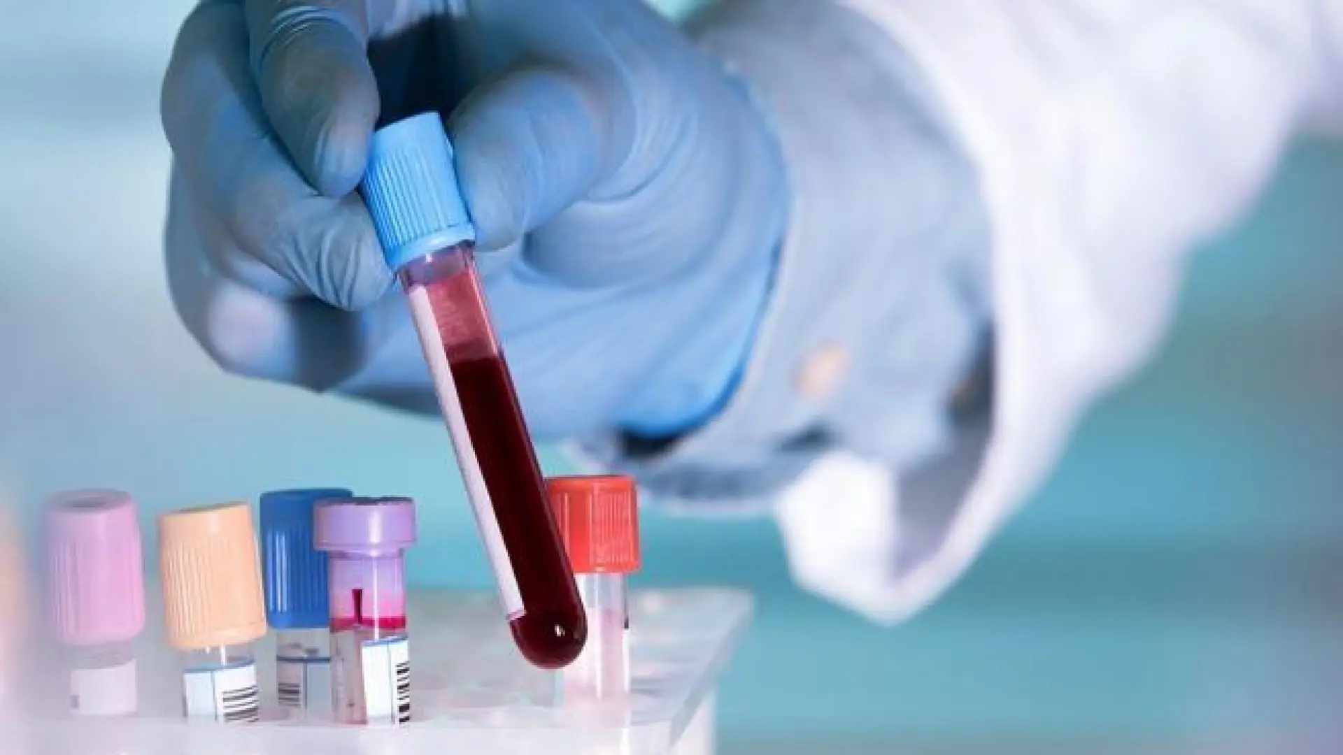 El único análisis de sangre que los médicos recomiendan hacerse en otoño