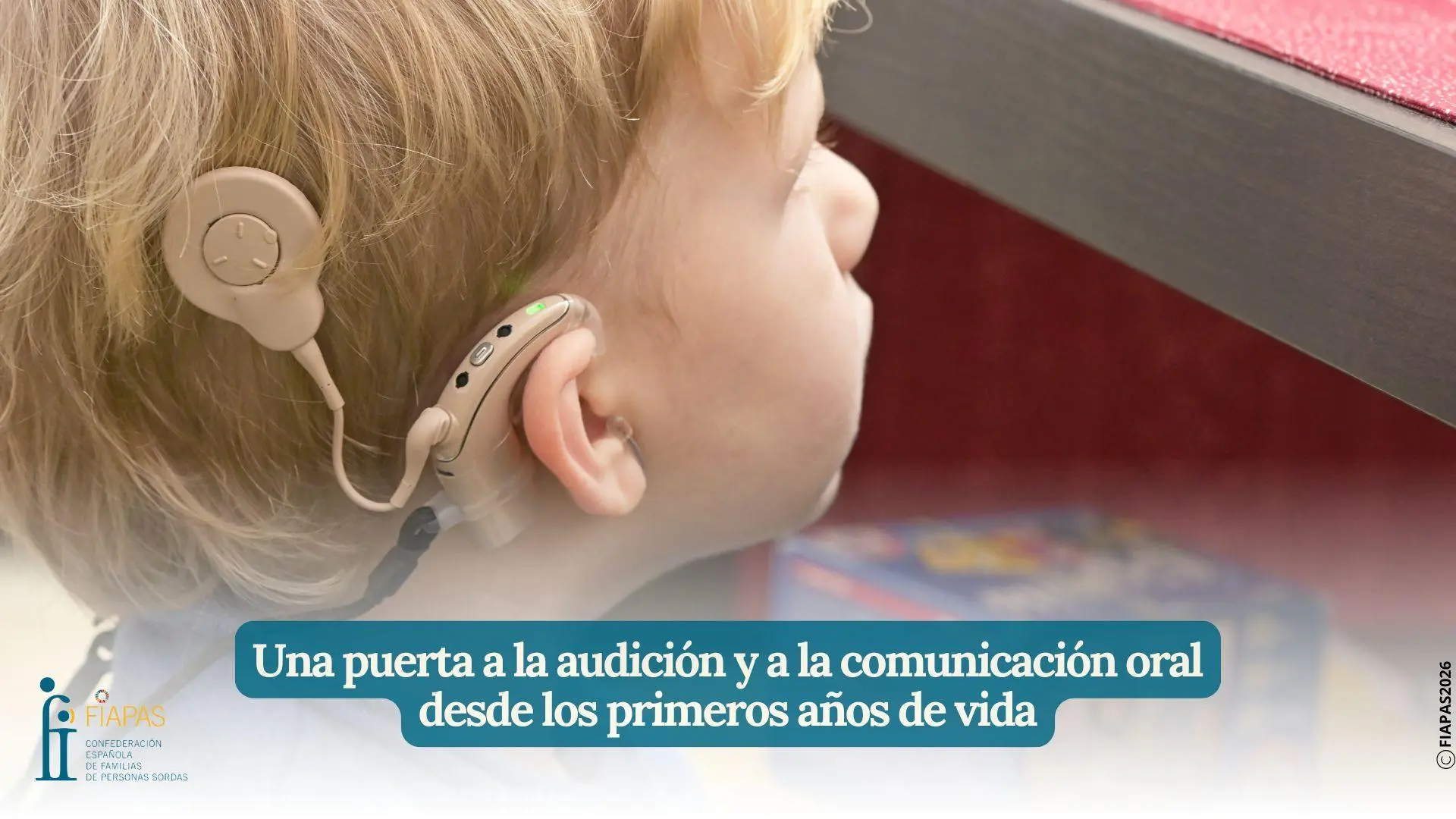Reivindican los implantes cocleares como "una puerta a la audición y a la comunicación oral" desde los primeros años de vida