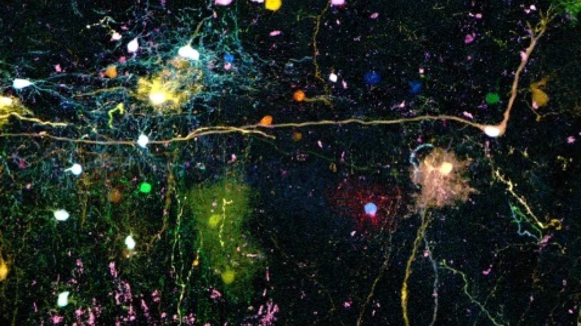 Por qué nos cuesta tanto cambiar? Inercia y plasticidad de los circuitos neuronales