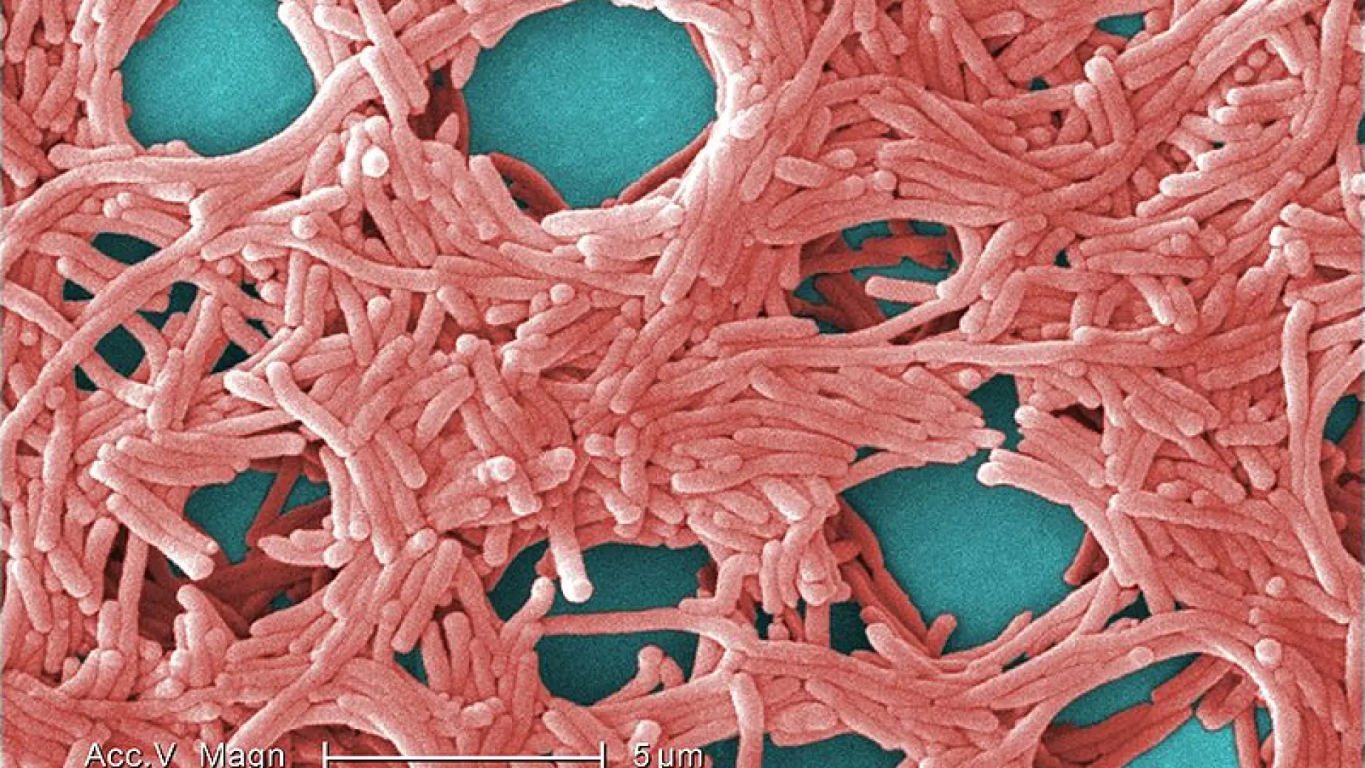 Un caso de legionella obliga a desinfectar 300 viviendas en una urbanización de Getxo