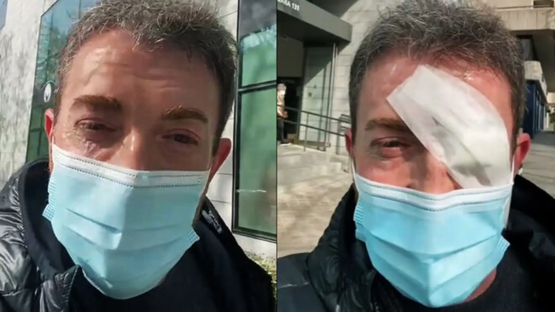 Pablo Motos pasa por quirófano: “Ahora soy un pirata”