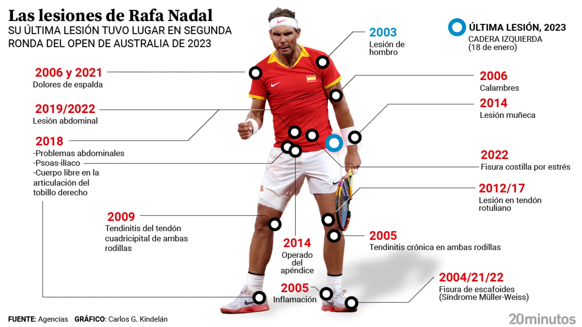La mayor batalla de Rafa Nadal: todas las lesiones que ha tenido thumbnail