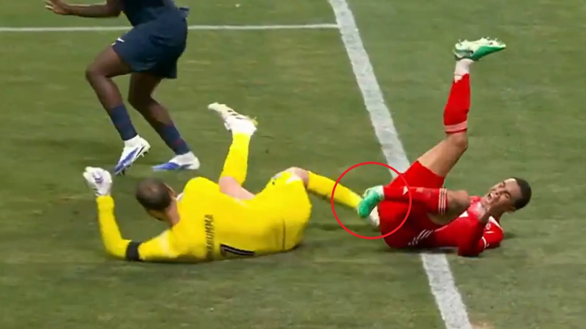 La impactante lesión de Jamal Musiala en el PSG – Bayern: retirado en camilla, entre lágrimas, tras un acción con Donnarumma