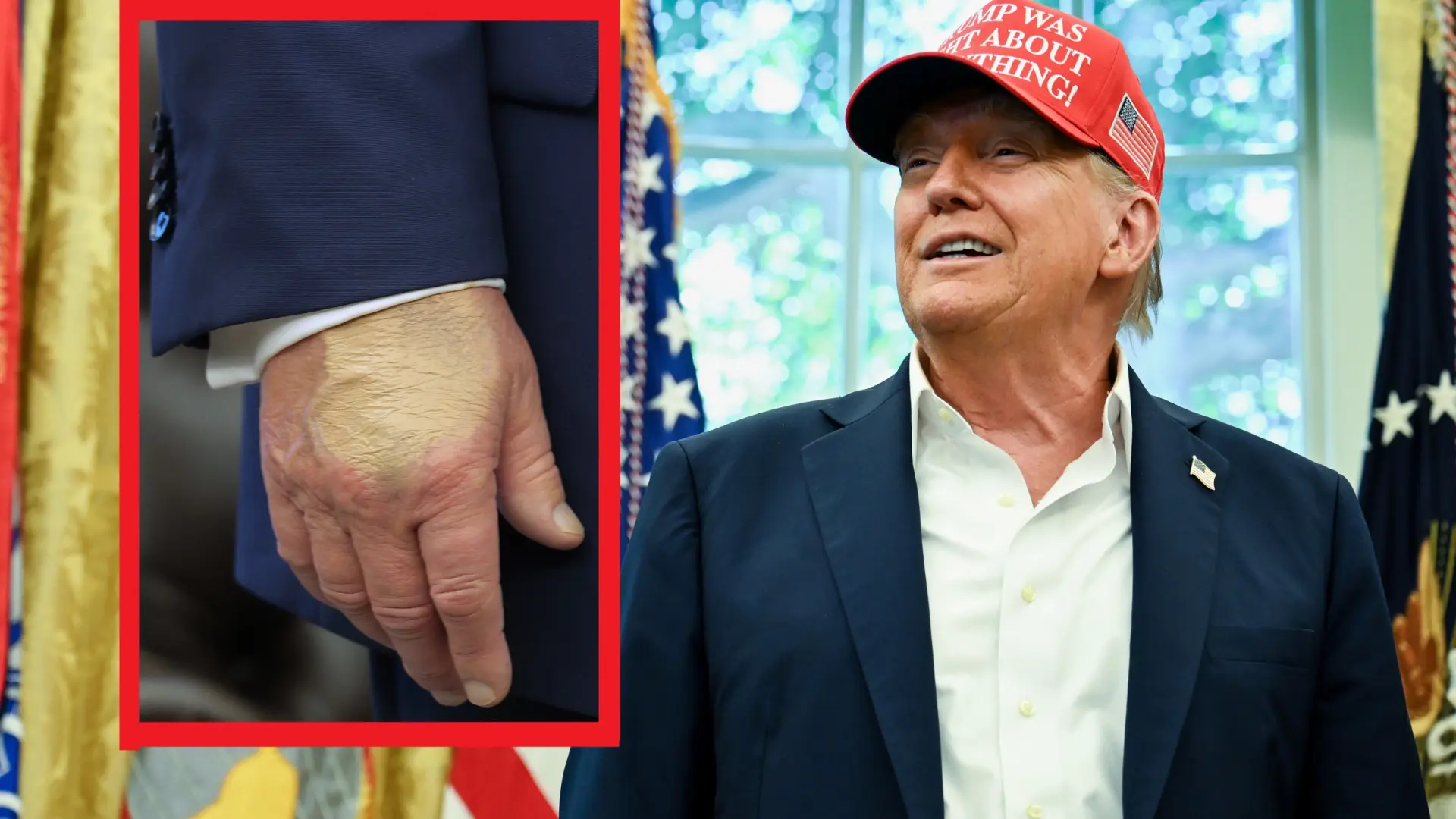 La salud de Trump bajo la lupa: maquillaje en mano aviva especulaciones