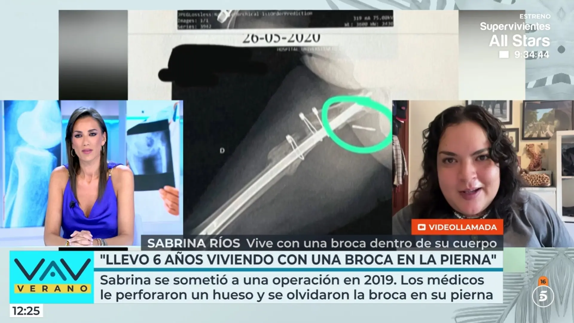 Denuncia que lleva seis años con una broca en su cuerpo tras una negligencia médica: "Es un dolor que no puedo explicar"