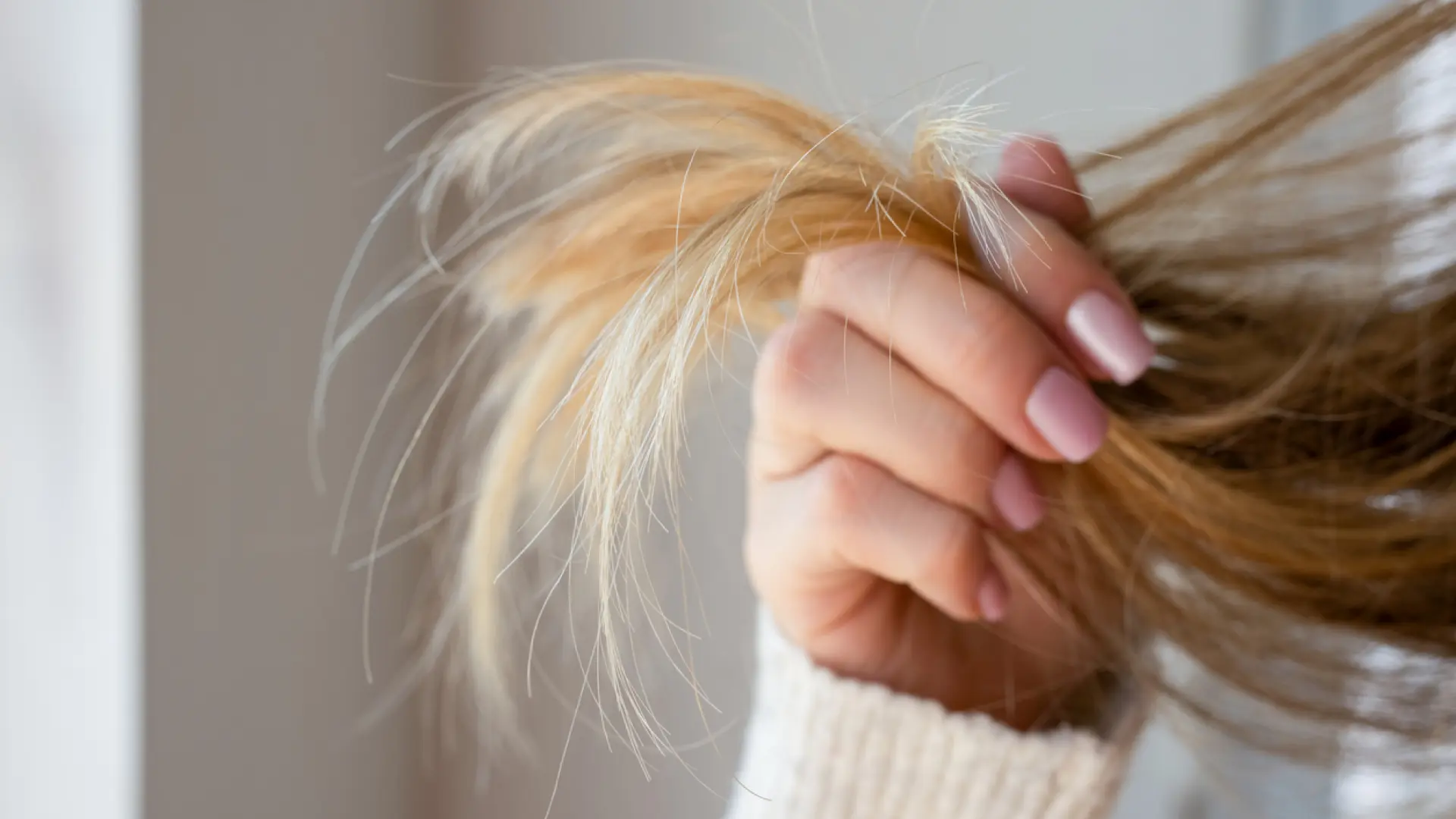 La dermatóloga Ana Molina avisa de los efectos del sol en el cabello: "Es un pelo dañado"