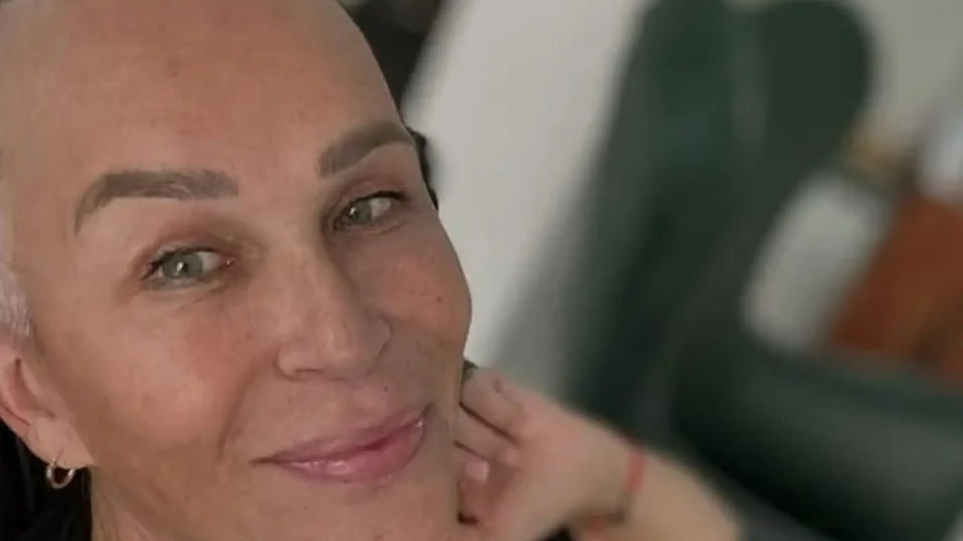 La primera imagen de Antonia San Juan, sin pelo y con una sonrisa, en plena quimioterapia: "No siento vergüenza"