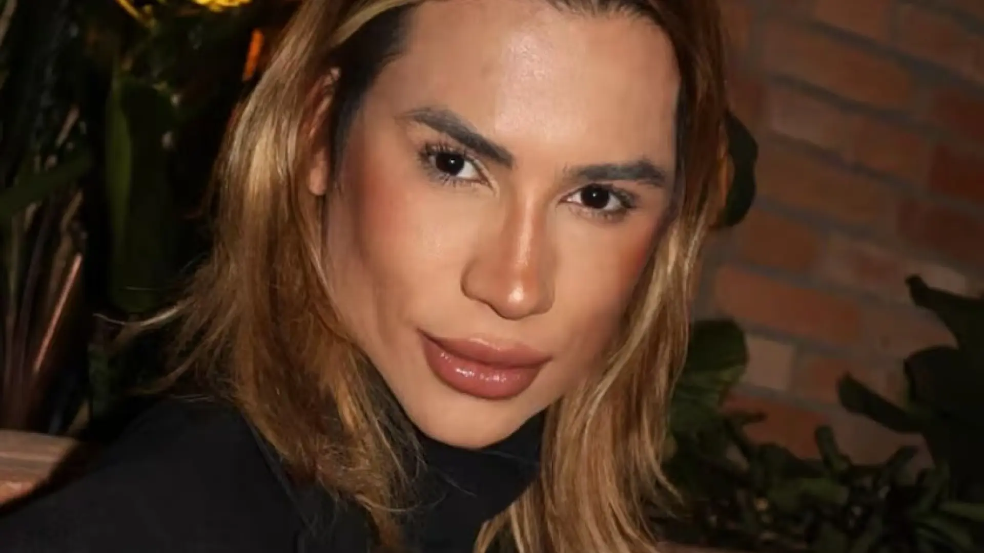 Muere el 'influencer' Júnior Dutra a los 31 años tras someterse a la cirugía de moda 'foxy eyes': "Queremos justicia"