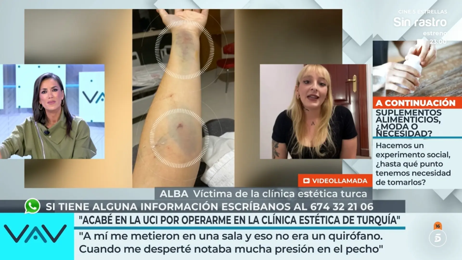 Denuncia las negligencias de una clínica estética en Turquía: "Fui a cumplir un sueño y ha sido un infierno"