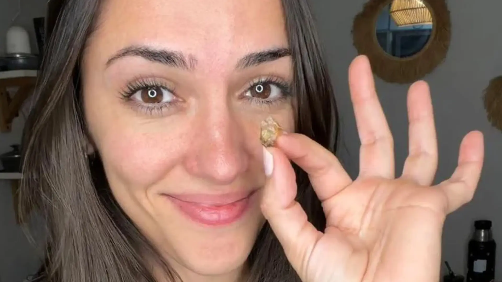 Extraen de la nariz de una 'influencer' un trozo de cinta adhesiva que llevaba insertado desde hace 35 años