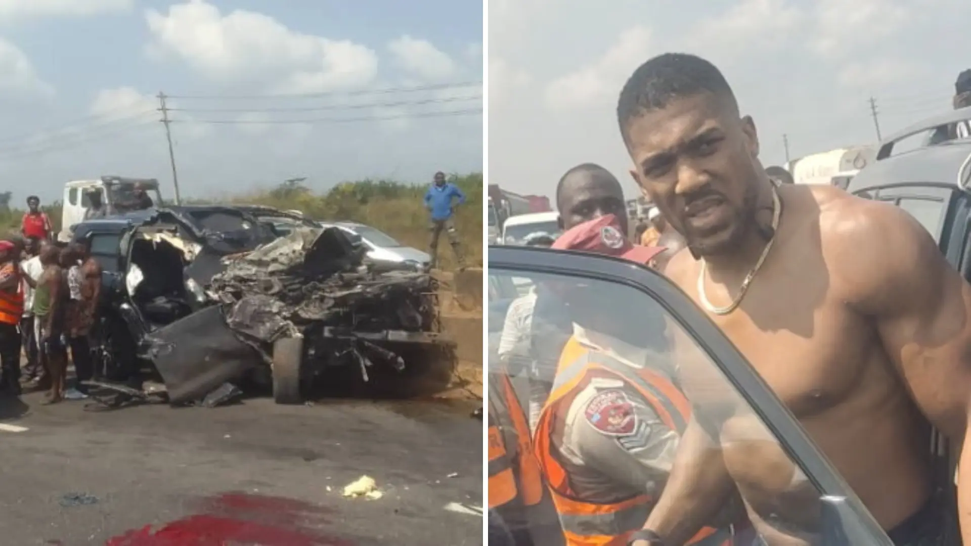 Anthony Joshua recibe el alta médica tras su terrible accidente de tráfico y la Policía ya interroga al conductor