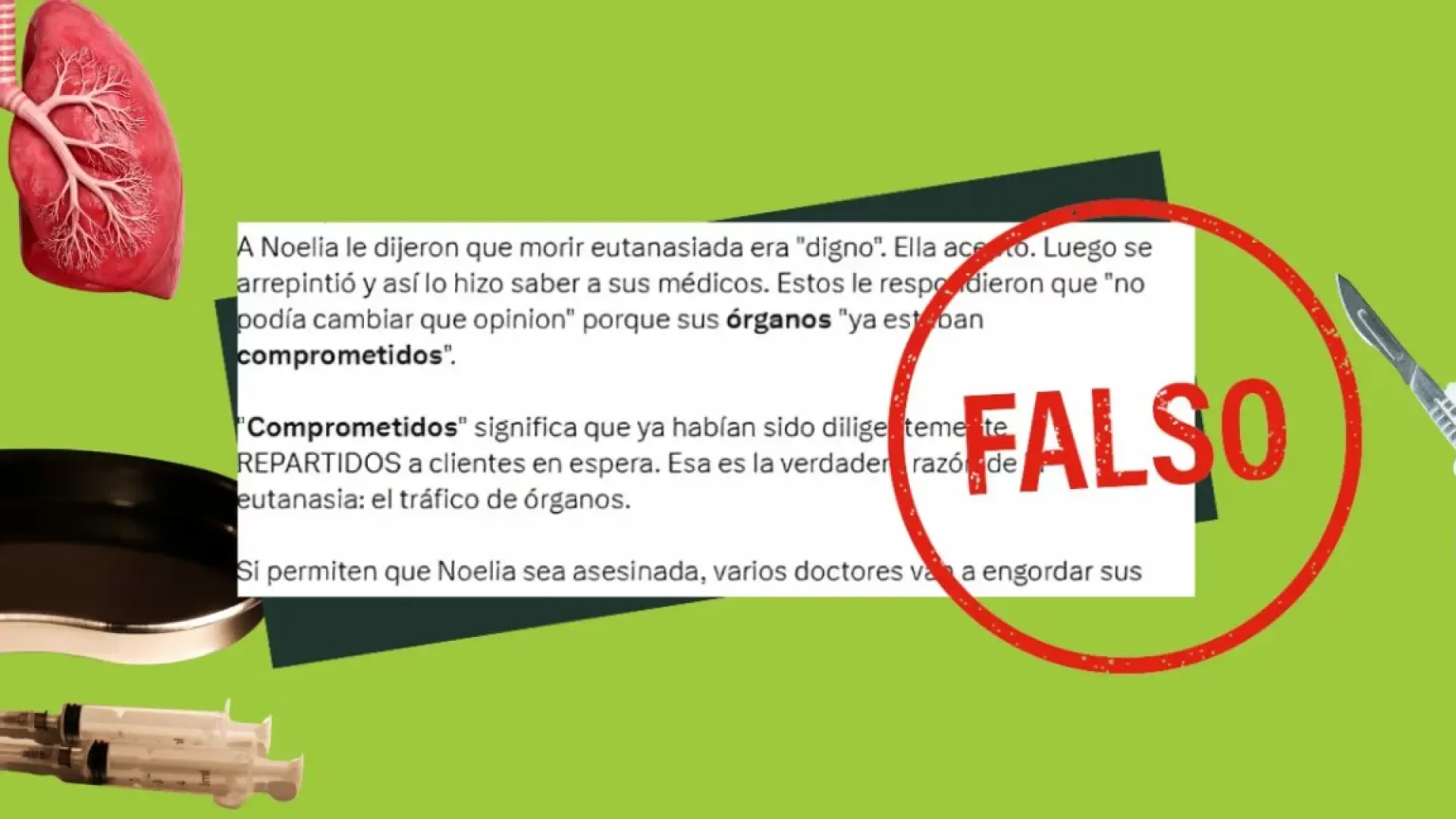 
         Eutanasia y donación: es imposible asignar un órgano a un receptor específico antes de que se produzca el fallecimiento 
    