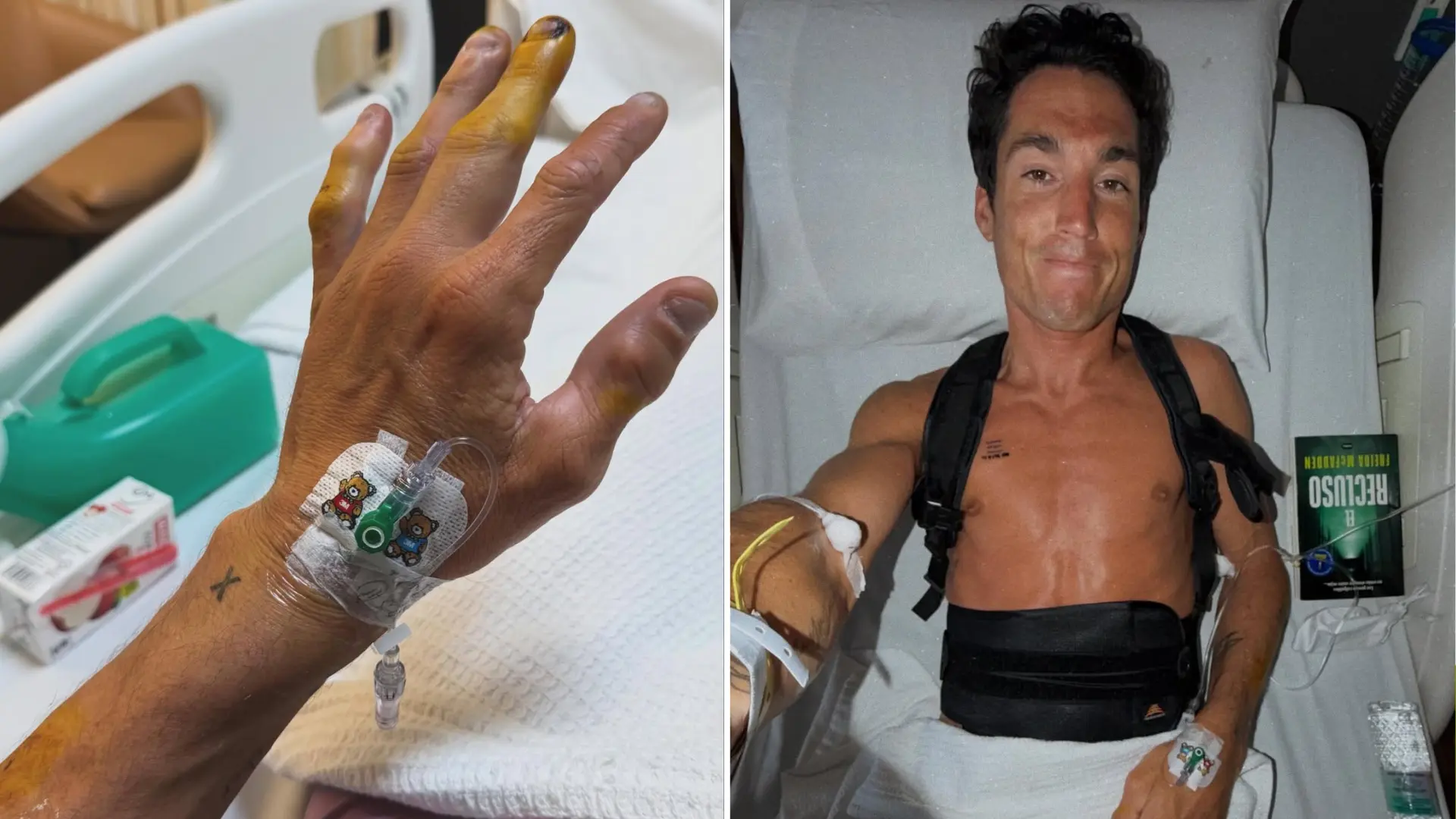 
         Aleix Espargaró sufre "un accidente muy grave" en un test en Sepang: tiene cuatro vértebras rotas 
    