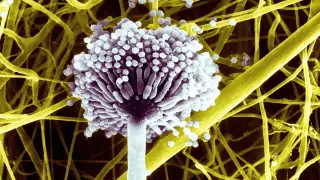 Aspergillus Niger.