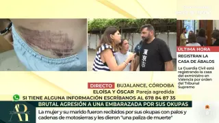 La pareja ha atendido al 'El programa de Ana Rosa'.