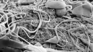Espermatozoides sobre el óvulo, mostrando los poros de su capa externa reducidos por acción de la proteína oviductina.