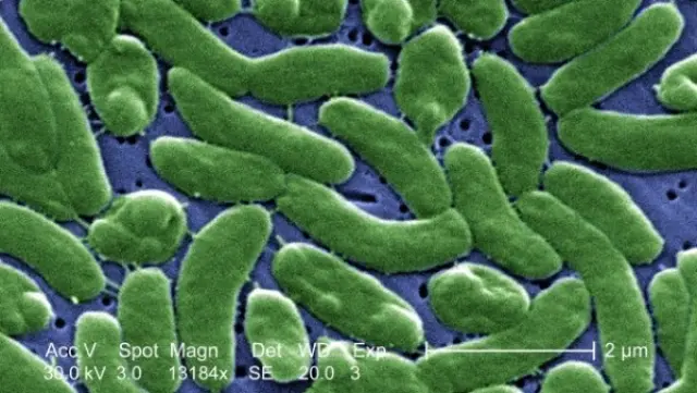 Vibrio vulnificus