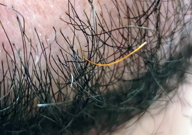 Aunque parezca mentira, la barba de este hombre tiene un único pelo anaranjado que destaca sobre el resto de vello negro. (peteskees)