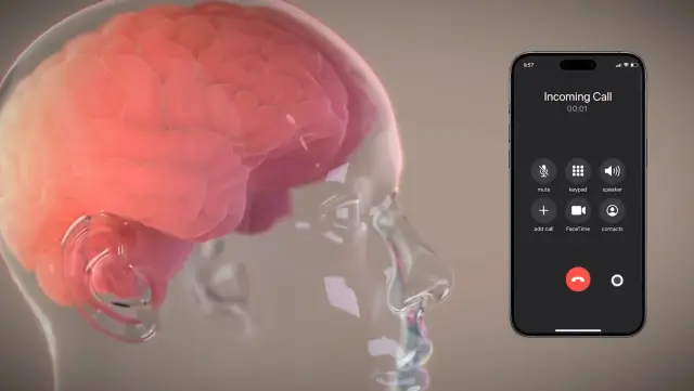 La empresa estadounidense Neuralink, propiedad de Elon Musk, ha anunciado que ha implantado el primer chip cerebral, en un humano.