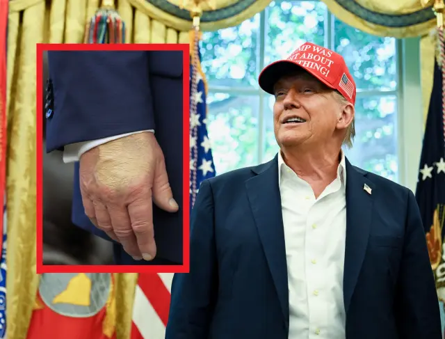 El presidente de Estados Unidos Donald Trump, con un detalle de su mano, cubierta de maquillaje.