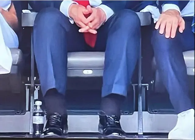 Detalle de los tobillos hinchados de Donald Trump.