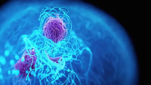 Ilustración que representa células de cáncer de páncreas.