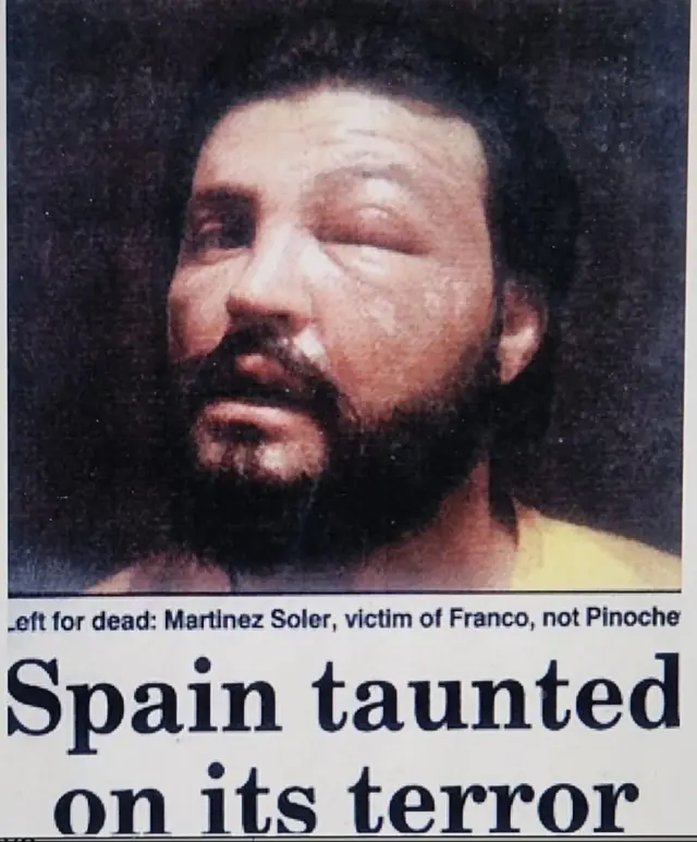 Mi cara, tras el secuestro y torturas del 2 de marzo de 1976, hace medio siglo.