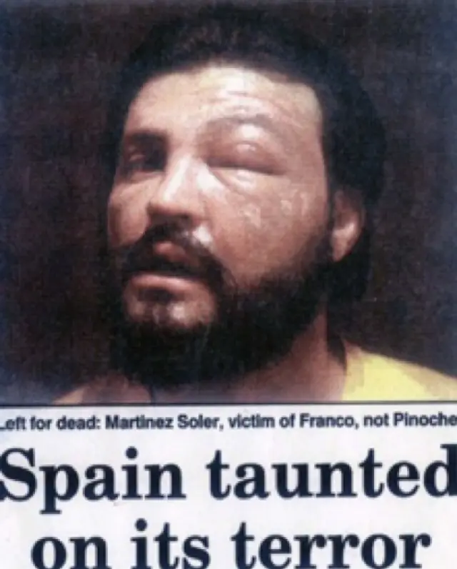 Foto publicada en la prensa inglesa años después de mi secuestro. Con esa cara, llena de quemaduras acudí a la fiesta en casa de Roger acompañado por mis dos policías de escolta.