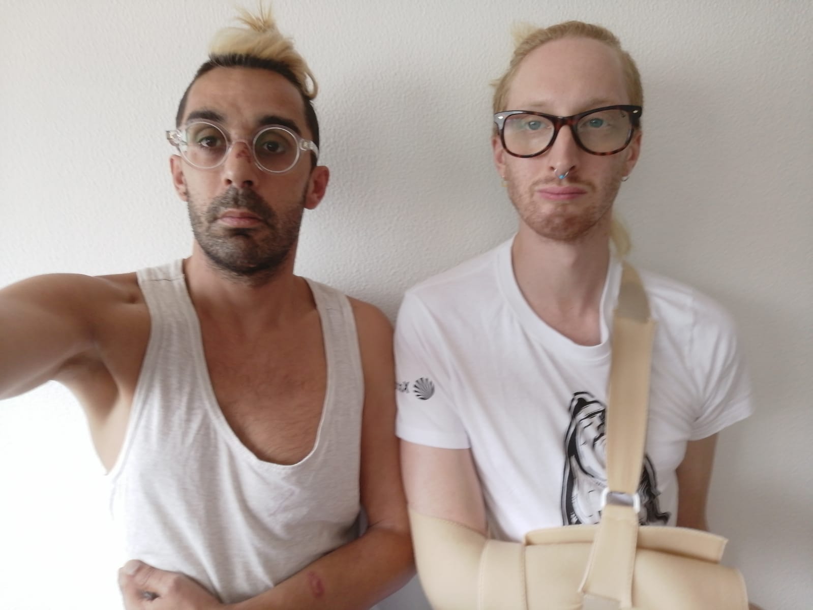 Una pareja gay denuncia la agresión de un hombre con una porra ...