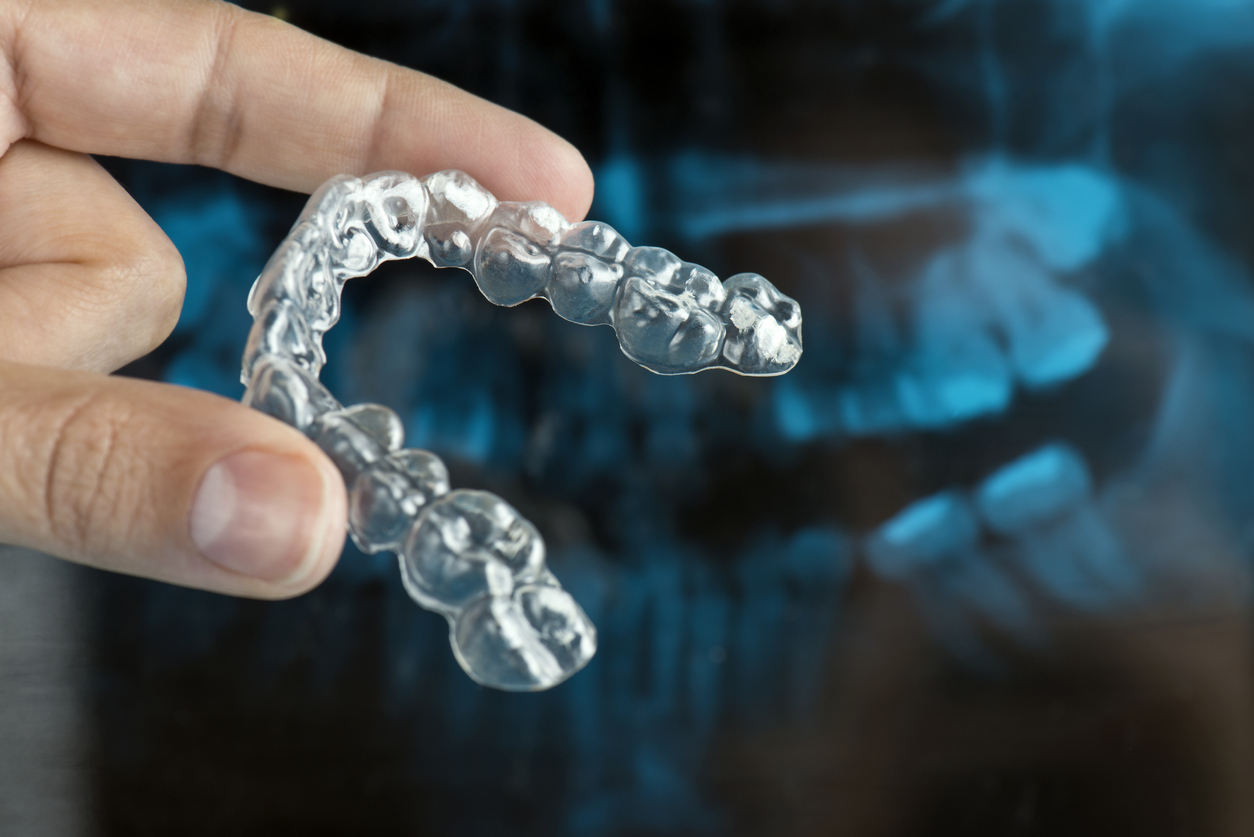 Il bite notturno protegge i denti dall'usura causata dal bruxismo.