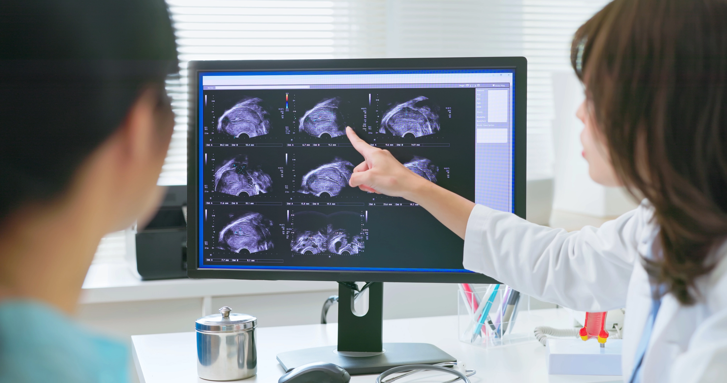 Consiglio medico per vedere il risultato dell'ecografia.