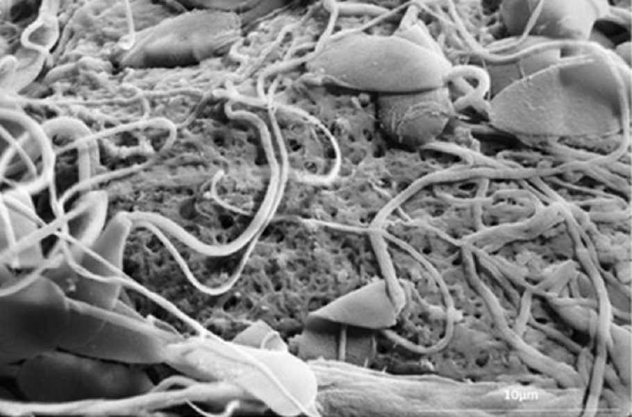 Espermatozoides sobre el óvulo, mostrando los poros de su capa externa reducidos por acción de la proteína oviductina.